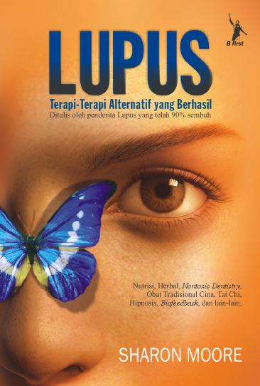 Lupus